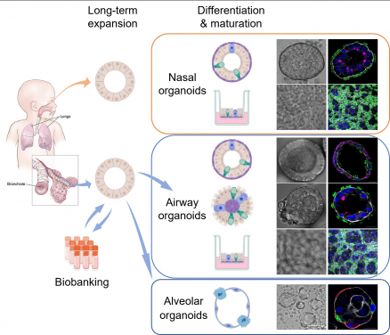 The research team induced maturation in long-term expandable organoids and generated nasal, airway and alveolar organoids that contain all major epithelial cell populations in the human respiratory tract.
 